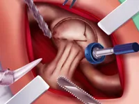 https://timunmini.id/game/princess-hips-surgery